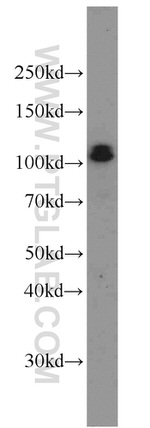 CUL4B Antibody in Western Blot (WB)