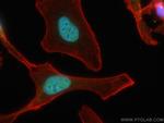 CUL4B Antibody in Immunocytochemistry (ICC/IF)