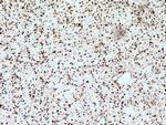 CUL4B Antibody in Immunohistochemistry (Paraffin) (IHC (P))