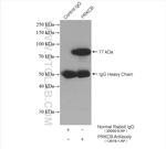 PKC beta Antibody in Immunoprecipitation (IP)
