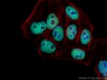 HDAC2 Antibody in Immunocytochemistry (ICC/IF)