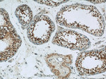 HDAC2 Antibody in Immunohistochemistry (Paraffin) (IHC (P))