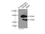 HDAC2 Antibody in Immunoprecipitation (IP)