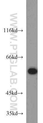 HDAC2 Antibody in Western Blot (WB)