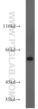 HDAC2 Antibody in Western Blot (WB)