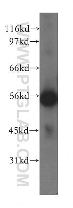 SKAP2 Antibody in Western Blot (WB)