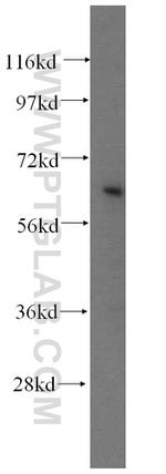 NFE2L1 Antibody in Western Blot (WB)