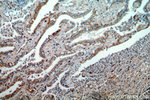 PLK4 Antibody in Immunohistochemistry (Paraffin) (IHC (P))