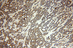 PLK4 Antibody in Immunohistochemistry (Paraffin) (IHC (P))