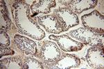 PLK4 Antibody in Immunohistochemistry (Paraffin) (IHC (P))