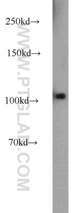 PLK4 Antibody in Western Blot (WB)