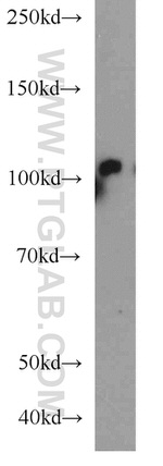 PLK4 Antibody in Western Blot (WB)