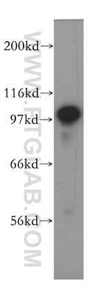 PLK4 Antibody in Western Blot (WB)