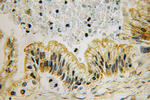 ILK Antibody in Immunohistochemistry (Paraffin) (IHC (P))