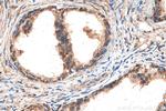 ILK Antibody in Immunohistochemistry (Paraffin) (IHC (P))