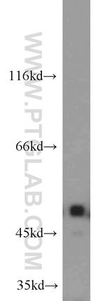 ILK Antibody in Western Blot (WB)