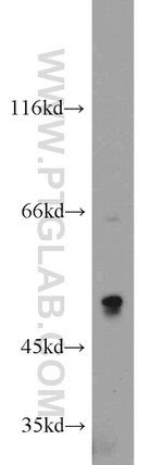 ILK Antibody in Western Blot (WB)