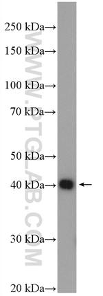 CHAD Antibody in Western Blot (WB)