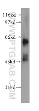 MSL3 Antibody in Western Blot (WB)