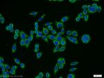 TPTE Antibody in Immunocytochemistry (ICC/IF)