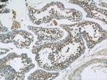 TPTE Antibody in Immunohistochemistry (Paraffin) (IHC (P))