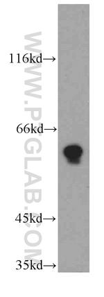 TPTE Antibody in Western Blot (WB)