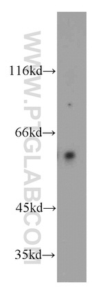 TPTE Antibody in Western Blot (WB)