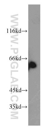 TPTE Antibody in Western Blot (WB)