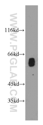 TPTE Antibody in Western Blot (WB)