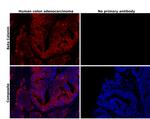 beta Catenin Antibody in Immunohistochemistry (Paraffin) (IHC (P))