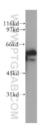 ETV5 Antibody in Western Blot (WB)