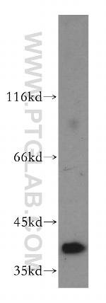 RRAGB Antibody in Western Blot (WB)