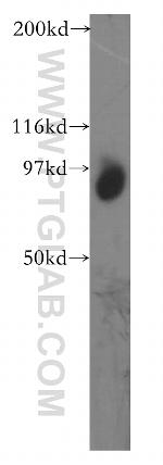 TGS1 Antibody in Western Blot (WB)