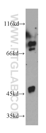 TRIM37 Antibody in Western Blot (WB)