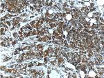 FGFR2 Antibody in Immunohistochemistry (Paraffin) (IHC (P))