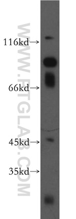 FGFR2 Antibody in Western Blot (WB)