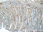 ARL8B Antibody in Immunohistochemistry (Paraffin) (IHC (P))