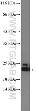 ARL8B Antibody in Western Blot (WB)