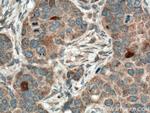 THRSP Antibody in Immunohistochemistry (Paraffin) (IHC (P))