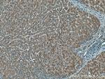 THRSP Antibody in Immunohistochemistry (Paraffin) (IHC (P))