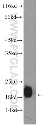 THRSP Antibody in Western Blot (WB)