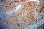 CALML5 Antibody in Immunohistochemistry (Paraffin) (IHC (P))