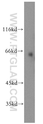 SLC1A4 Antibody in Western Blot (WB)