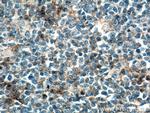 CD97 Antibody in Immunohistochemistry (Paraffin) (IHC (P))