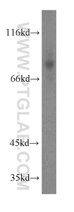 CD97 Antibody in Western Blot (WB)