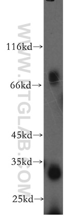 CD97 Antibody in Western Blot (WB)