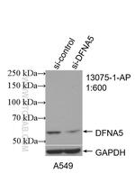 DFNA5 Antibody in Western Blot (WB)