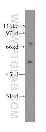 DFNA5 Antibody in Western Blot (WB)