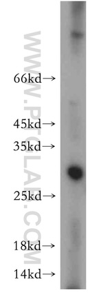 IL-17 Antibody in Western Blot (WB)