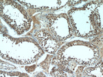DNAJC10 Antibody in Immunohistochemistry (Paraffin) (IHC (P))